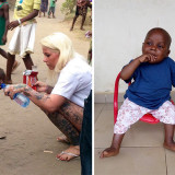 2-Year-Old ‘Witch Child’ Who Was Left To Die Makes Stunning Recovery
